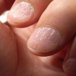 Are Clean Nails Essential For Wellness?